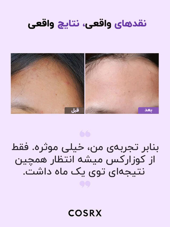 روشن کننده و لایه بردار AHA BHA لایه بردار کوزارکس حجم 150 میل اورجینال