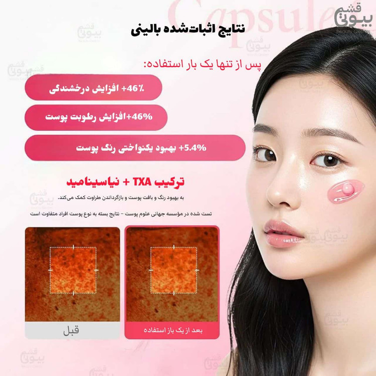 کرم کپسولی ترانگزامیک اسید و نیاسینامید 5% مدی کیوب | ضدلک و روشنکننده اورجینال